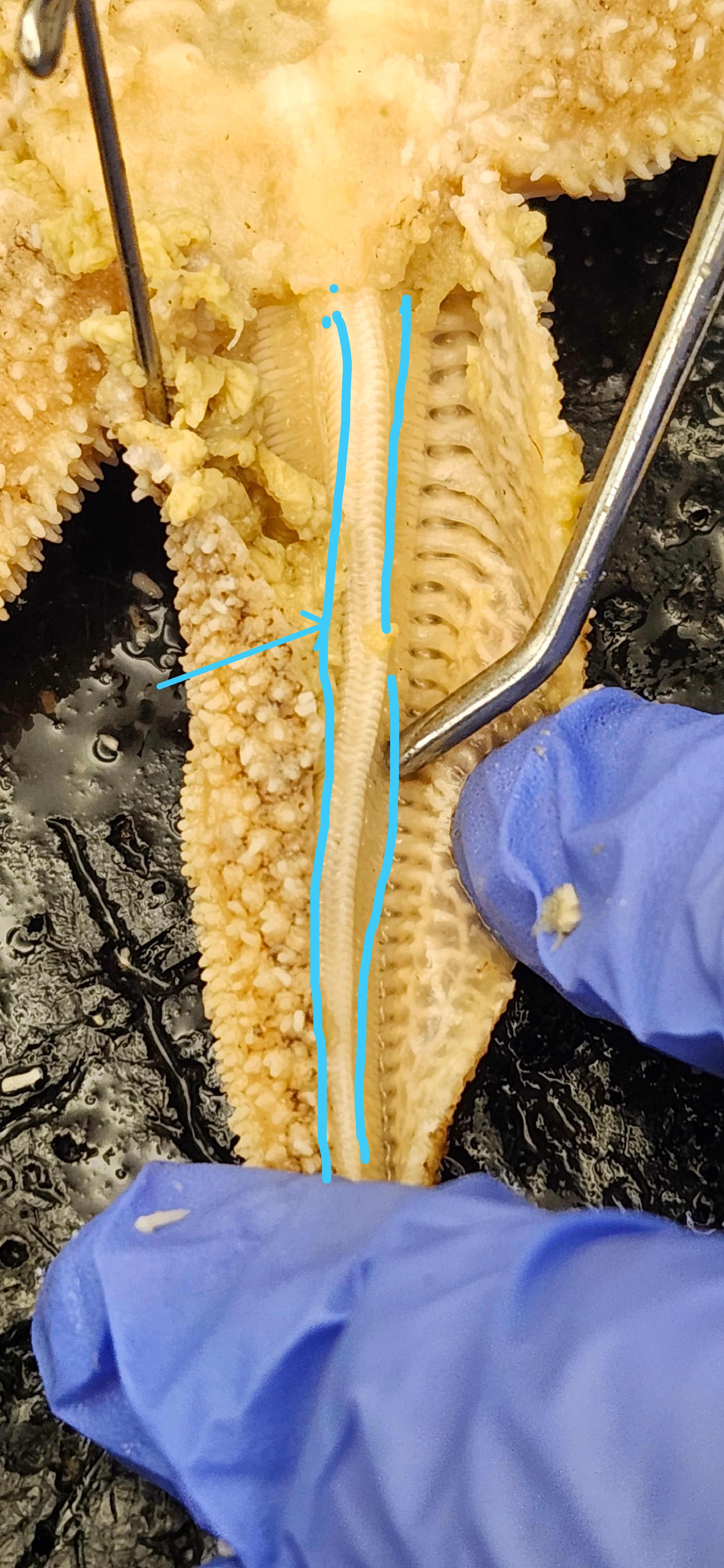 <p>Identify the structure </p>