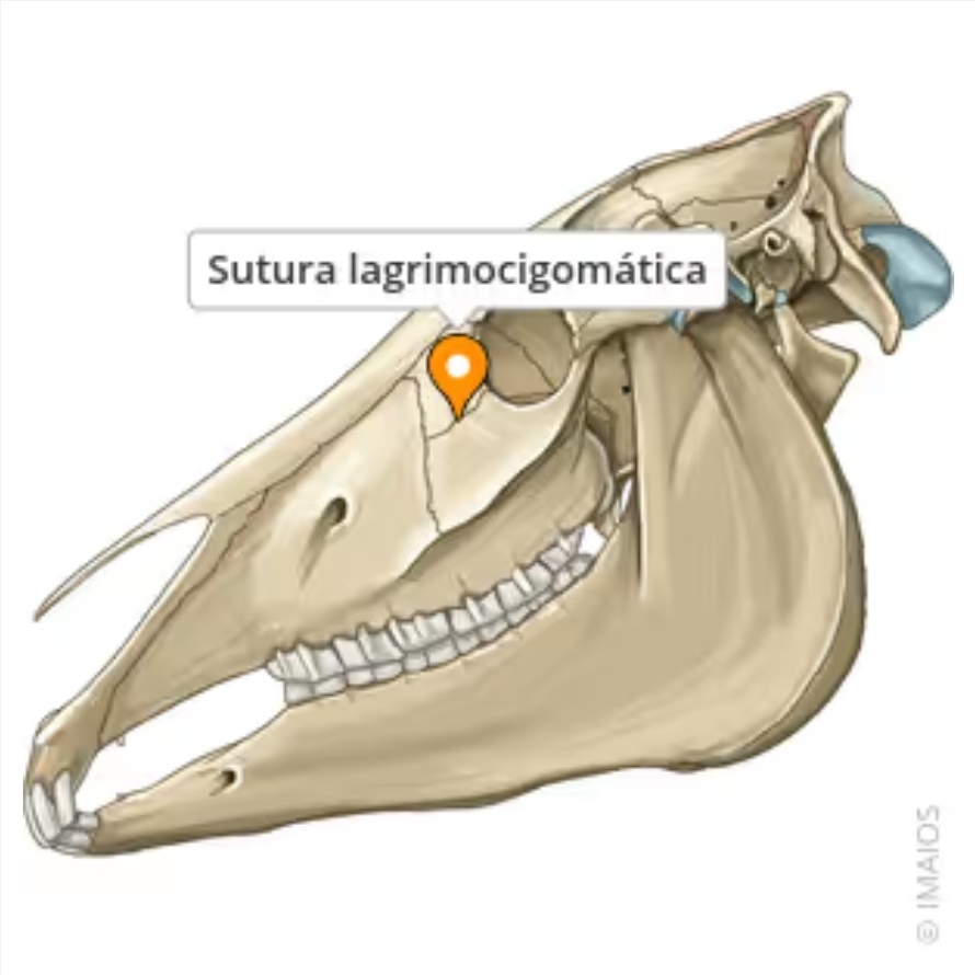 <p>sutura lagrimocigomatica</p>