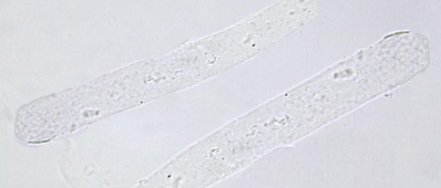 <p>Hyaline Cast</p>