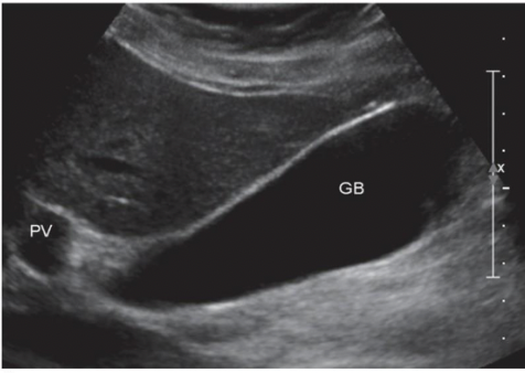 <p>What view of GB?</p>