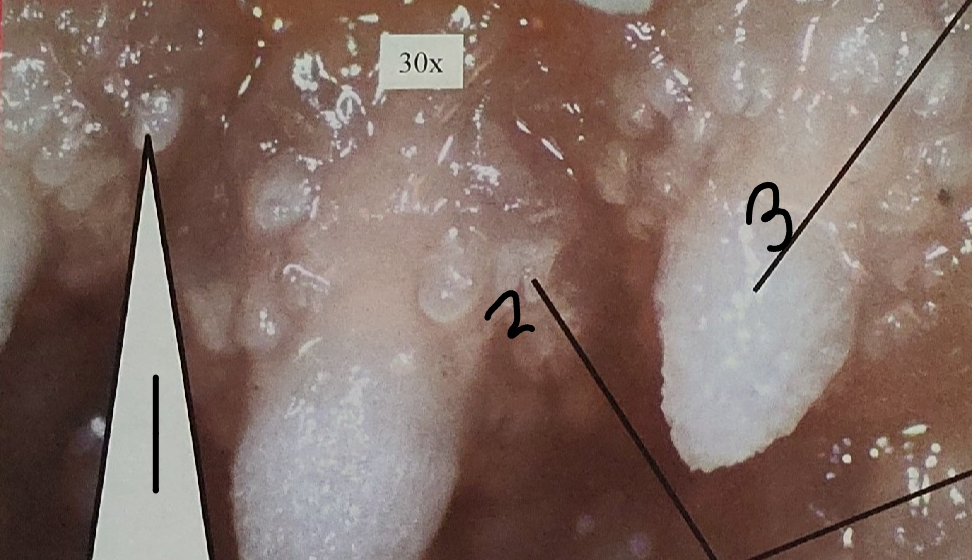 <p>point 2 on this sea star</p>