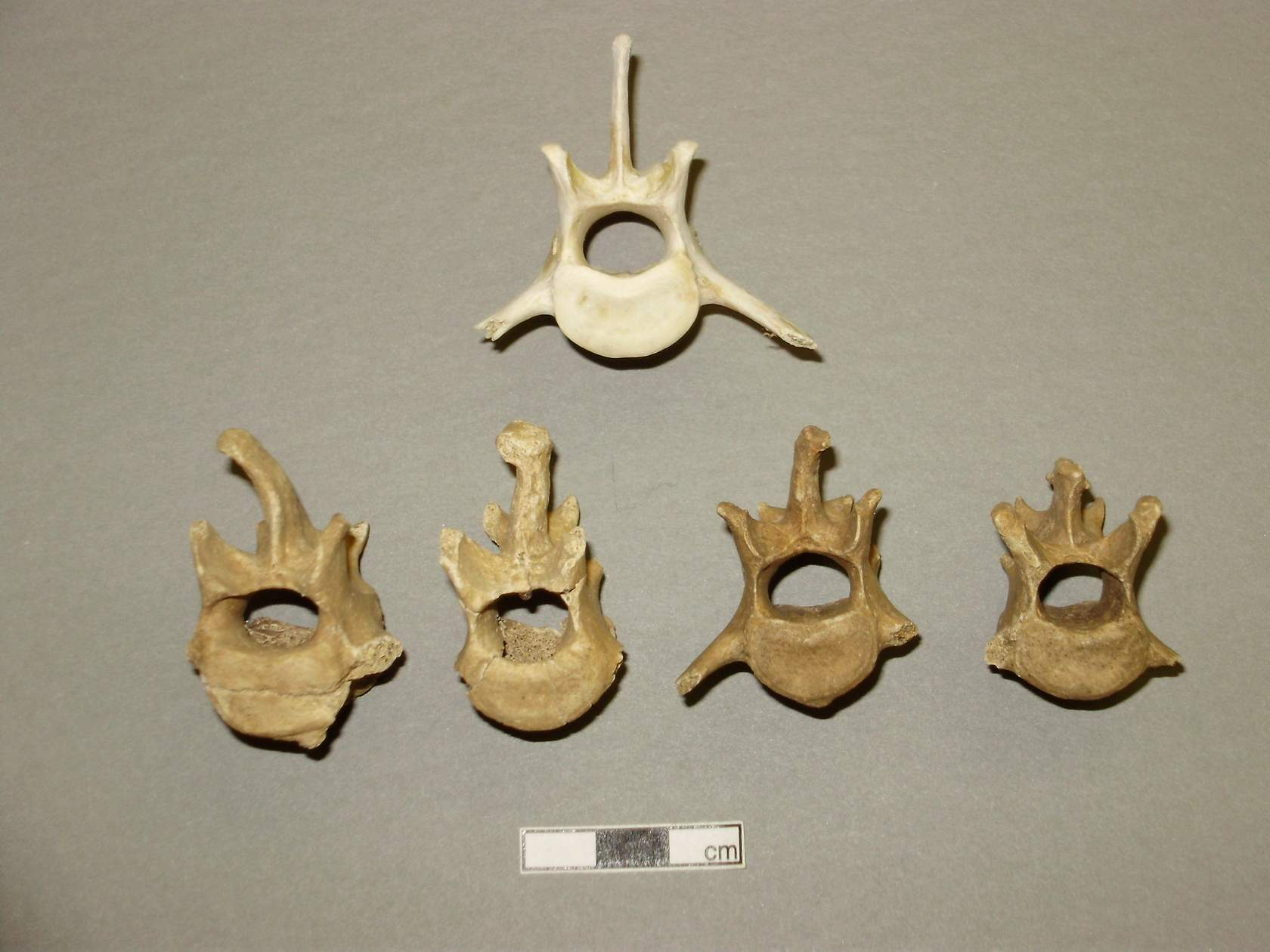 <p>Irregular bones </p>