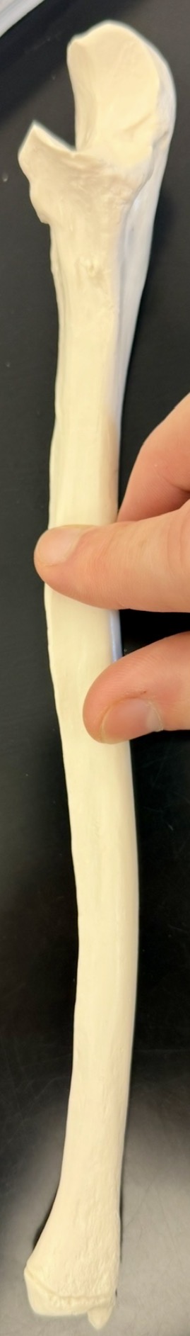 <p>What bone is this?</p>