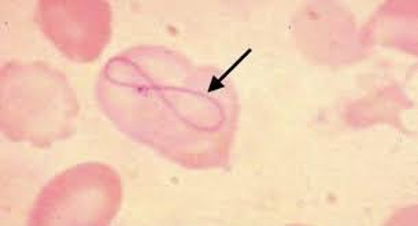 <p>Severe anemias, pernicious anemia, dyserythropoiesis</p>