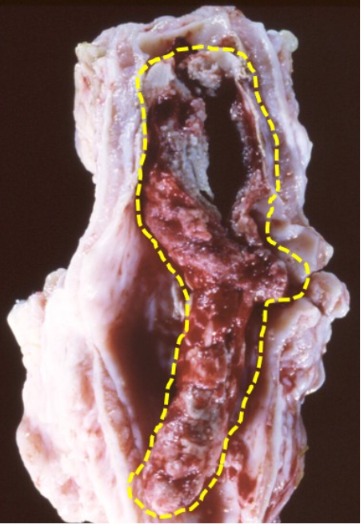 <p>Is this a post-mortem or ante-mortem clot?</p>