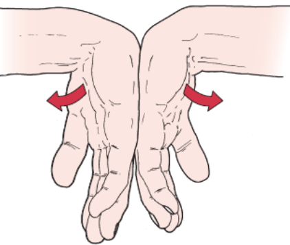 <ul><li><p><span>PURPOSE- Identify carpal tunnel compression of median nerve</span></p></li><li><p><span>DESCRIPTION- The examiner flexes the patient’s wrists maximally and holds this position for 1 minute by pushing the patient’s wrists together.</span></p></li><li><p><span>RESULT- Production of the patient’s symptoms is considered to be a positive test for carpal tunnel syndrome. The test may also involve flexing the wrist 60° before applying the pressure and whether symptoms are relieved when the examiner lets go. The wrist flexion is felt to make the test more sensitive</span></p></li></ul><p></p>
