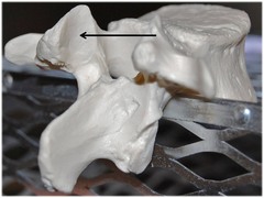 <p>Name this specific part of the lumbar vertebra. include directional term.</p>