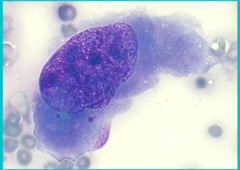 <p>What malignancy change is this cell showing?</p>