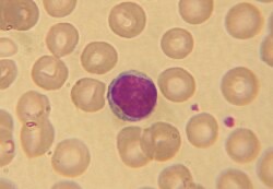 <p>lymphocytes</p>