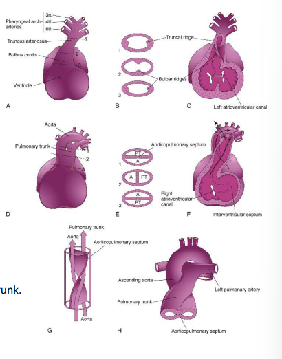 <ol><li><p>Conotruncal septum (aorticopulmonary septum) develops from ridges that form in the bulbus cordis and truncus arteriosus (bulbar/truncal ridges)</p></li><li><p>Ridges fuse to form a spiral septum that divides the bulbus cordis and the truncus arteriosus into 2 arterial channels: aorta &amp; pulmonary trunk </p></li><li><p>Spiralling > pulmonary trunk twists around the ascending aorta </p></li><li><p>Brings the future pulmonary trunk into communication with the R ventricle and the future aorta into communication with the L ventricle.</p></li><li><p>The distal bulbus cordis becomes incorporated into the walls of the definitive ventricles: R ventricle: infundibulum, which gives origin to the pulmonary trunk. L ventricle: walls of the aortic vestibule, the part of the ventricle inferior to the aortic valve</p></li></ol><p></p>
