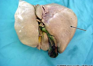 <p>what lobe of the liver is this?</p>