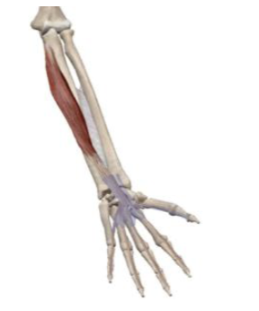 <p>what muscle and action is this </p>