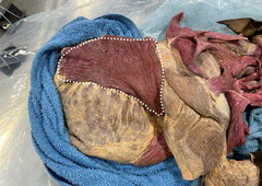 <p>What muscle is this?</p>