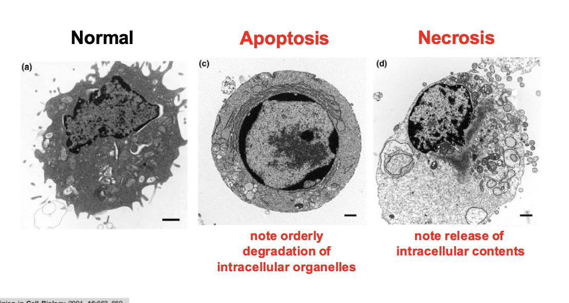 <p>Which is more neat and orderely: apoptosis or necrosis?</p>