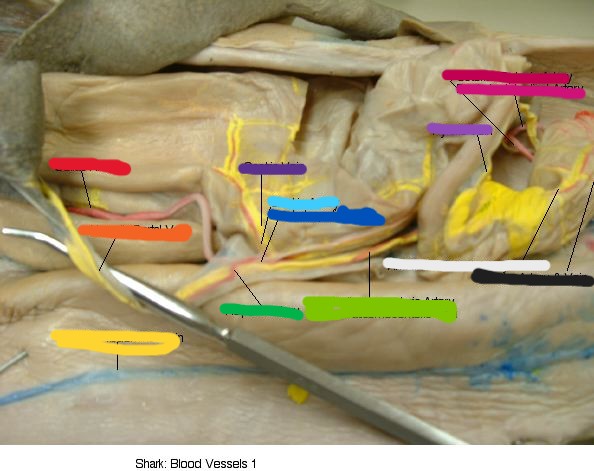 <p>what is the light pink part?</p>