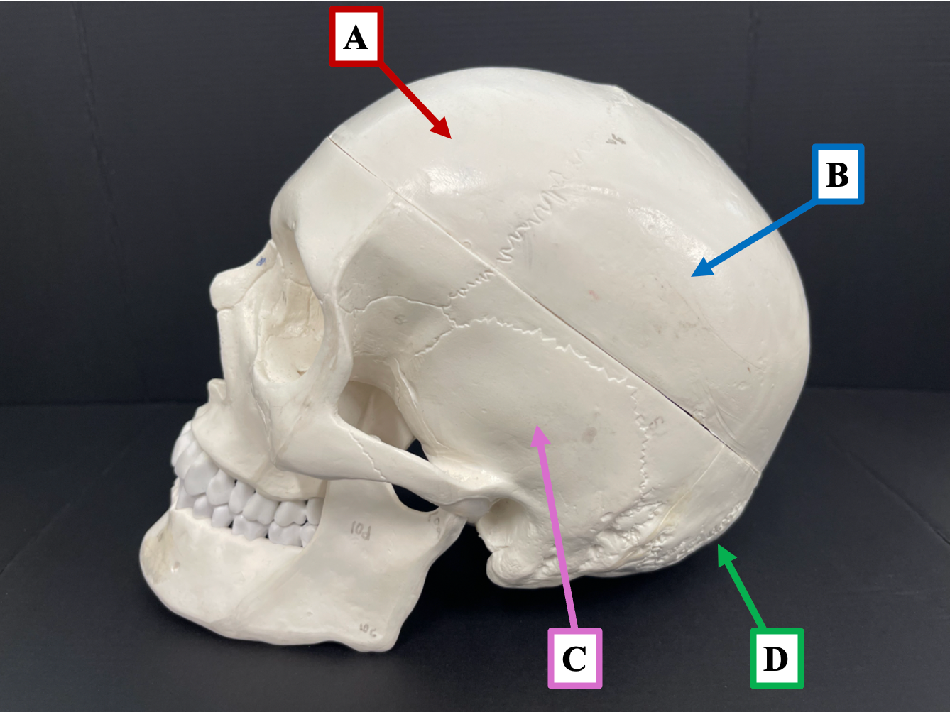<p>Identify the major bone of the skull that label <strong>C </strong> is pointing to.</p>