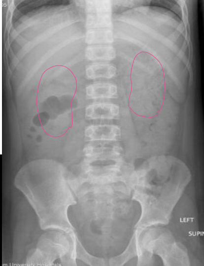 <p>What anatomy is outlined in this image?</p>