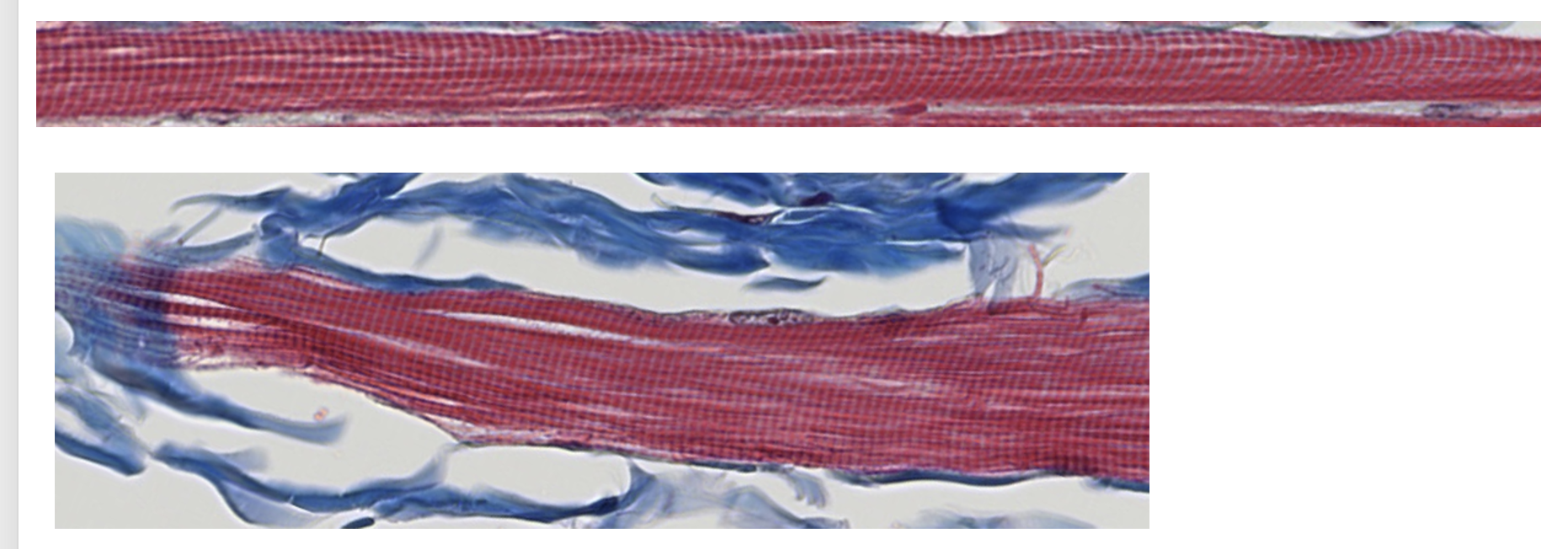 <p><span style="font-family: "Calibri Light";">1. Which structures create the light and dark banding pattern within the myofibrils? <br><br>2. Which of these structures create the light bands? Which create the dark bands?<br></span></p>