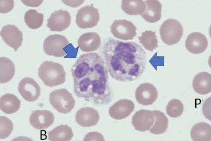 term image