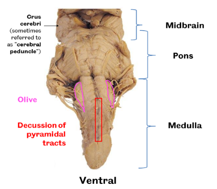 <p>ventral view of the brainstem</p><p>crus cerebri, olive, pyramid visible, transverse fibres of pons </p>