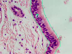 <p>identify the indicated tissue</p>