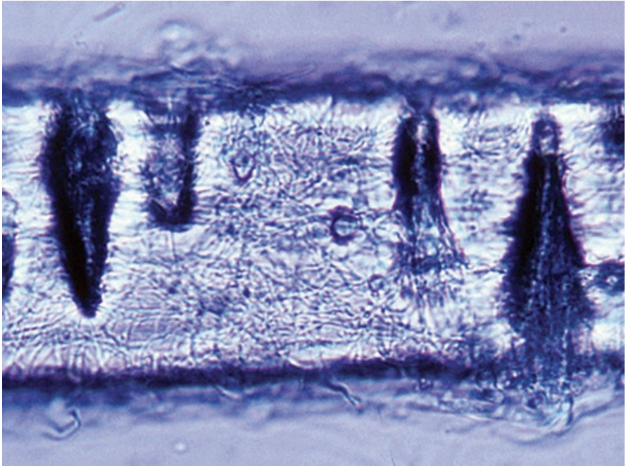<p>-Looks similar to T. rubrum</p><p>-Positive for hair perforation</p><p>-Dermatophyte</p>