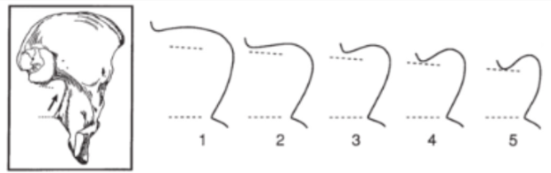 <p>Sciatic Notch Morphology - Pelvis </p>