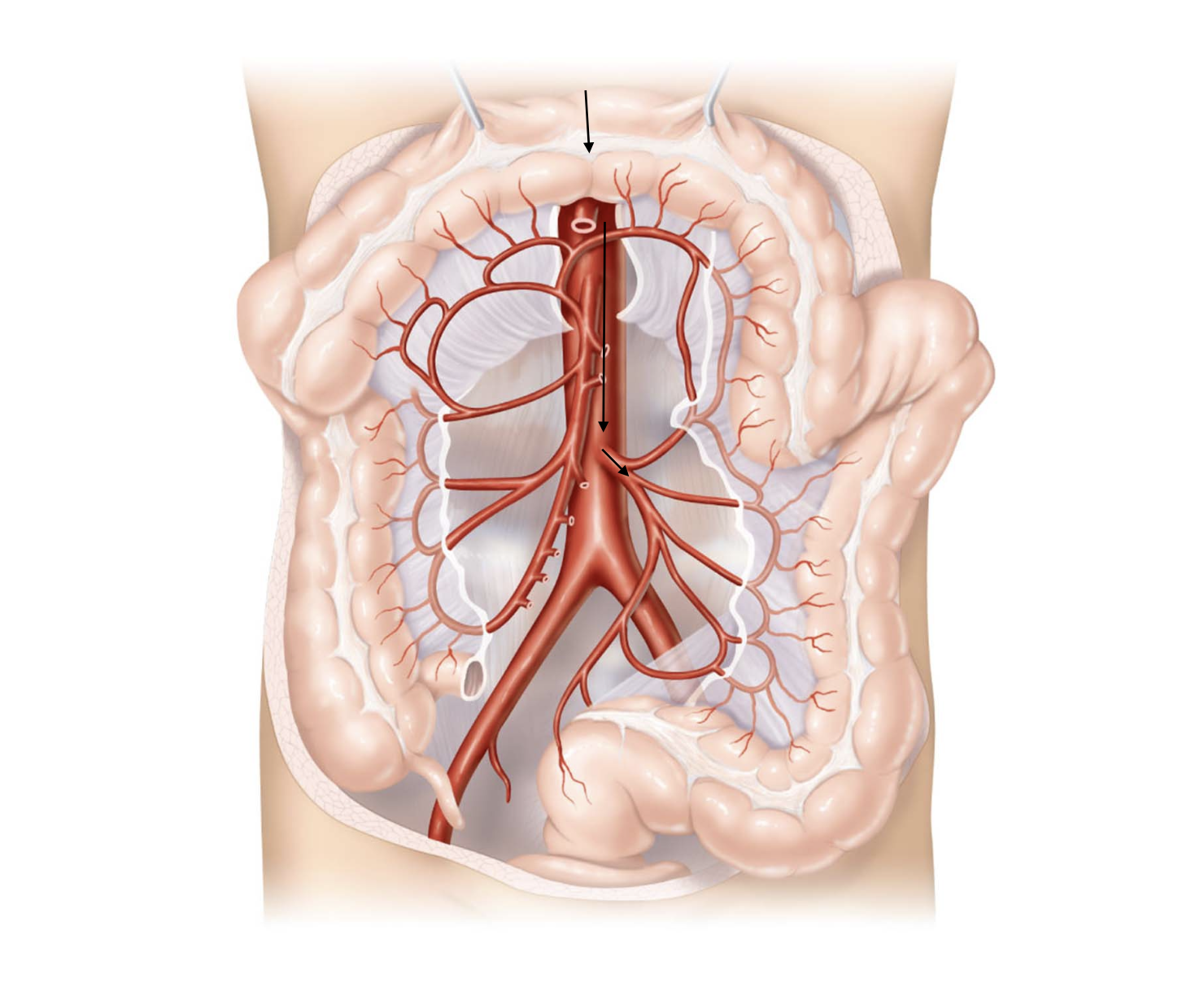 <p>Aorta</p><ul><li><p>→ thoracic aorta</p><ul><li><p>→ abdominal aorta</p><ul><li><p>→ inferior mesenteric artery</p><ul><li><p>→ large intestine</p></li></ul><p></p><ul><li><p>← inferior mesenteric vein</p></li></ul></li><li><p>← hepatic veins</p></li></ul></li><li><p>← inferior vena cava</p></li></ul></li></ul><p>Right Atrium</p>