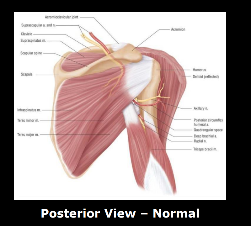 <p>Young, <40 years old, repetitive overhead motion</p>
