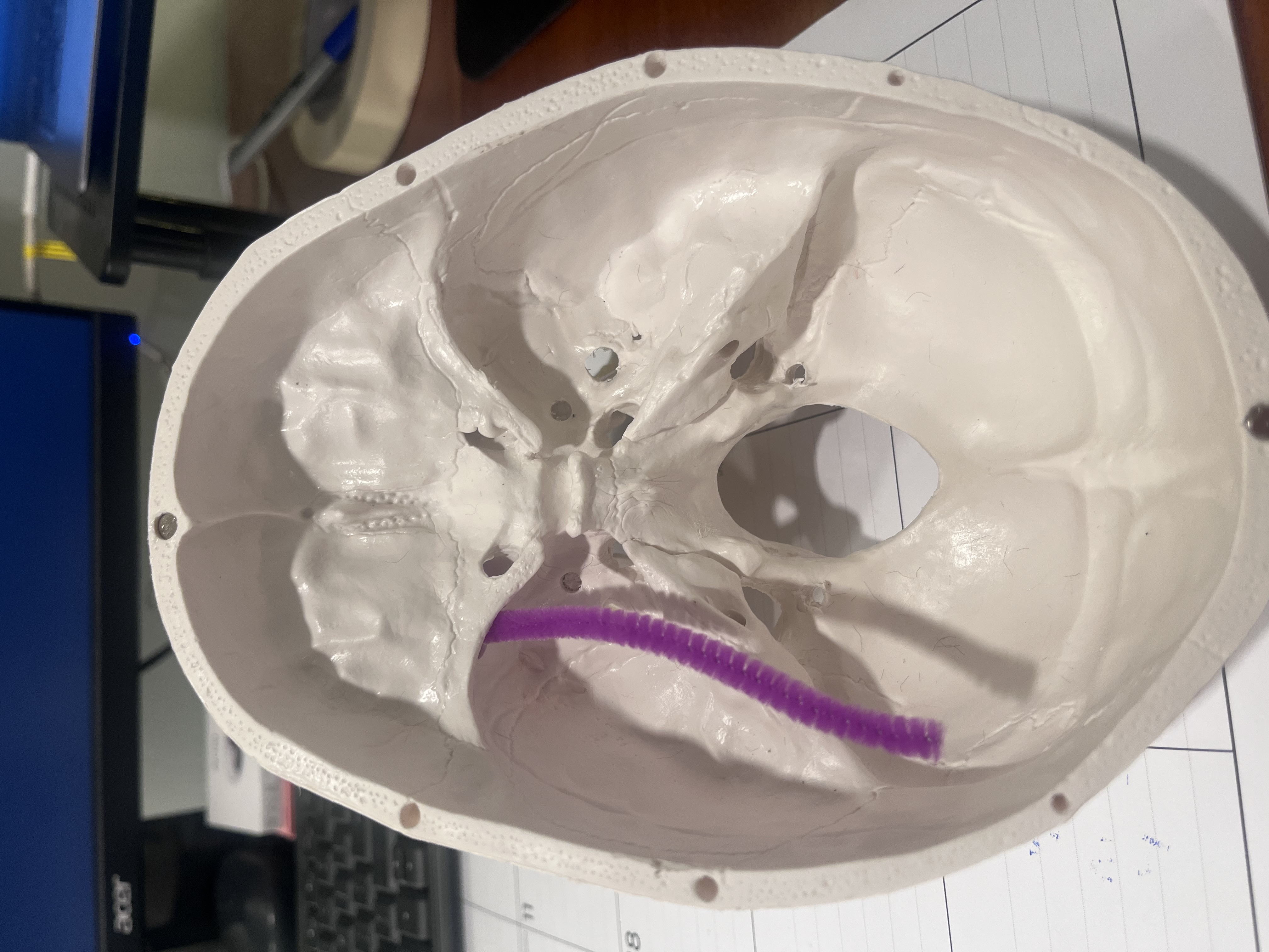 <p>What cranial nerve(s) are represented by the purple pipe cleaner?</p>
