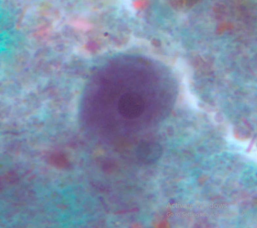 <ol><li><p>Entamoeba polecki</p></li><li><p>Trophozoite</p></li></ol><p></p>