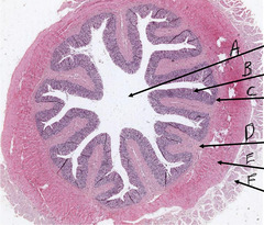 <p>What is indicated by the arrow labeled 'B' in this slide of colon?</p>