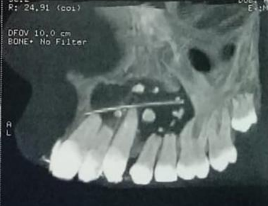 term image
