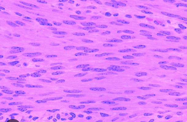<ul><li><p>VOLUNTARY</p></li><li><p>spindle shaped cells </p></li><li><p>central single mucleus </p></li><li><p><strong>lack of</strong> visible striations </p></li></ul><p></p>