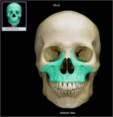 <p>Which skull bone is shown?</p>