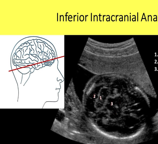 <p>Label the Inferior Intracranial Anatomy</p>
