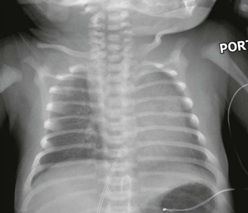 <p>AP Chest: Is this Image Good?</p>