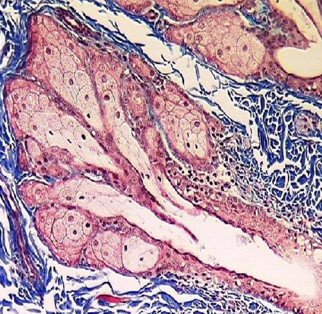 <p>What type of gland?</p>