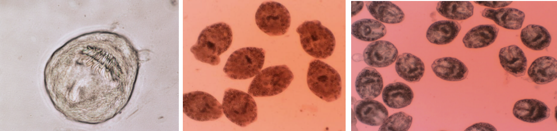 <p><strong>Zdjęcie niewynicowanych protoskoleksów <em>Echinococcus granulosus</em> i</strong></p><p class="p1"><strong>opis</strong></p>