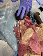 <p>What muscle is this?</p>