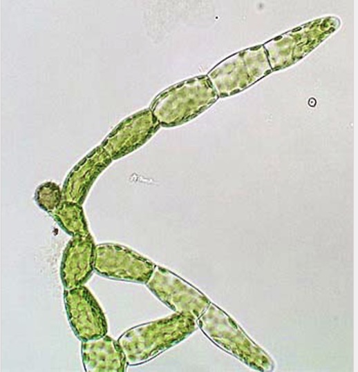 <p>A branched, thread-like chain of cells formed during the early development of a moss gametophyte following spore germination.</p>