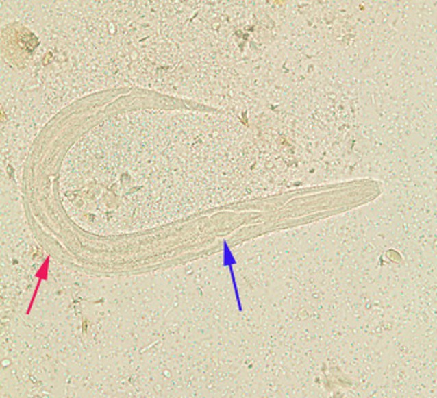 <p>Identify the organism</p>