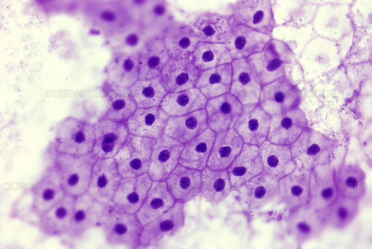 <p>Simple Squamous Epithelium</p>