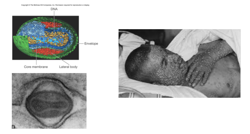<p>Some viruses lack clearly defined capsids e.g poxviruses</p>