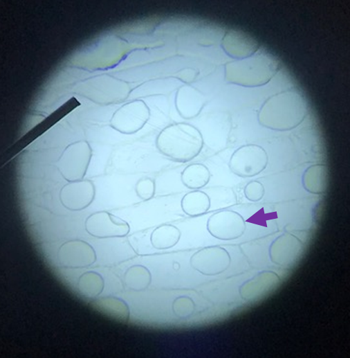 <p><span>The cells below have been exposed to a hypertonic solution (10% NaCl). Which of the following statements best describes what is happening to these cells? (focus on the cell with the purple arrow on the right side of the picture)</span></p>