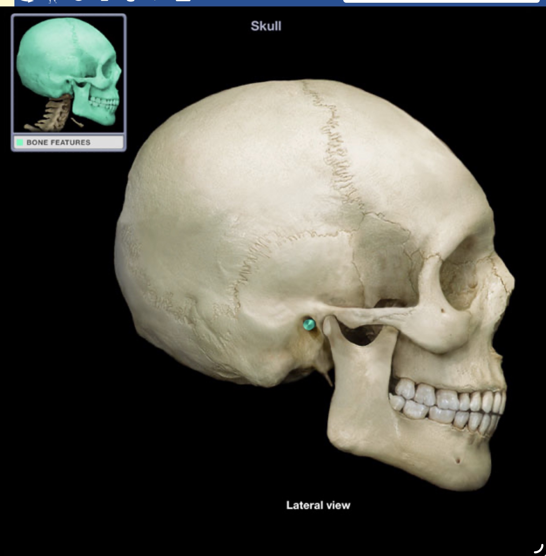 <p>An opening in the temporal bone extending to the inner ear.</p>