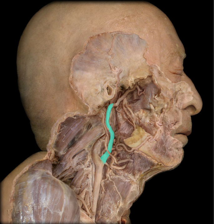 <ul><li><p><strong>Origin: </strong>Common carotid (at bifurcation)</p></li><li><p><strong>Course: </strong>Ascends in neck</p></li><li><p><strong>Distribution: </strong>Exterior of head (except orbit), Face, Meninges, and Neck structures</p></li><li><p><strong>Branches: </strong>Superior thyroid, Ascending pharyngeal, Lingual, Facial, Occipital, Posterior auricular, Maxillary, and Superficial temporal</p></li><li><p><strong>Comment: </strong>Not contained in carotid sheath</p></li></ul><p></p>