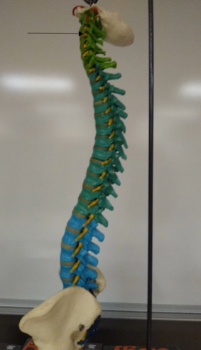 <p>What is this portion of the vertebrae?</p>