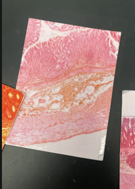 <ul><li><p>Mucosa: Simple columnar epithelium (gastric pits make it “blocky”)</p></li><li><p>Submucosa</p></li><li><p>Muscularis: Smooth muscle (3 layers)</p></li><li><p>Serosa</p></li></ul><p></p>
