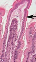 <p>what epithelium is this (jejunum)</p>